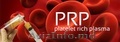 (  PRP,  platelet-rich plasma),   Плазмолифтинг в Кишиневе,  Молдове! В кабинете ла