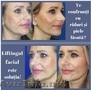 Lifting facial pentru un profil facial tânăr